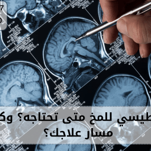 رنين مغناطيسي للمخ