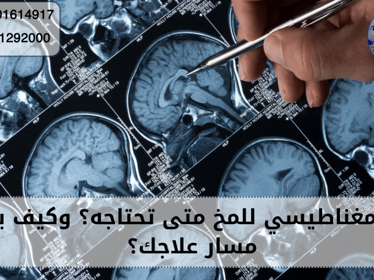 رنين مغناطيسي للمخ