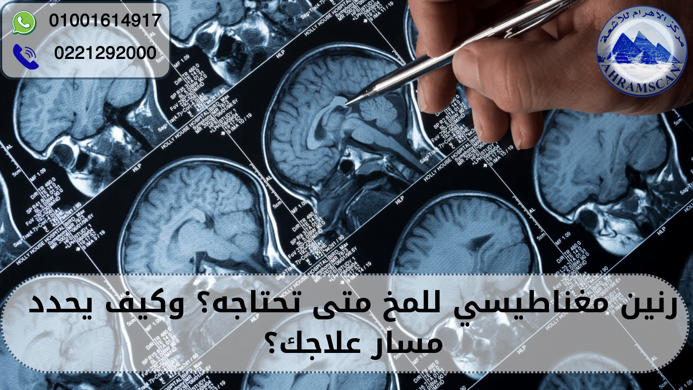 رنين مغناطيسي للمخ