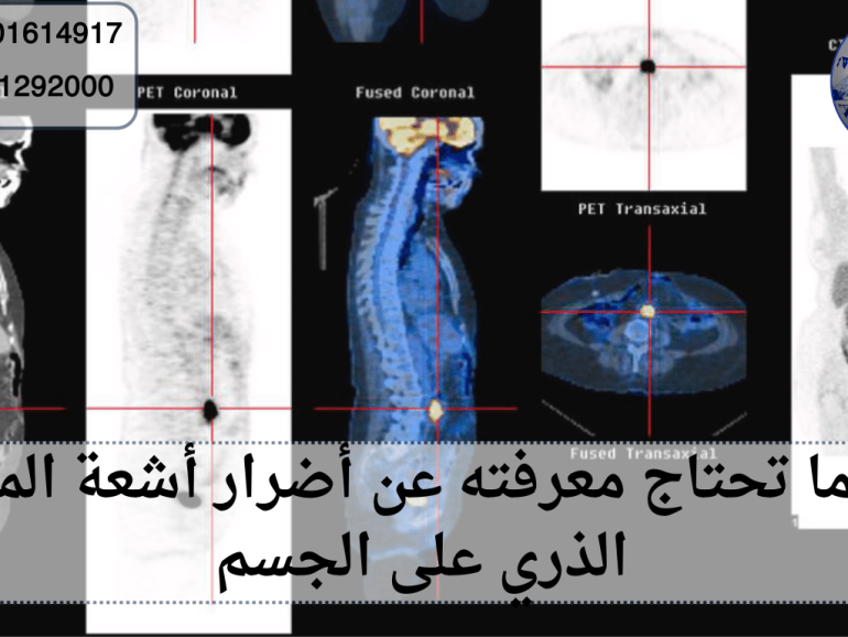 أضرار أشعة المسح الذري على الجسم