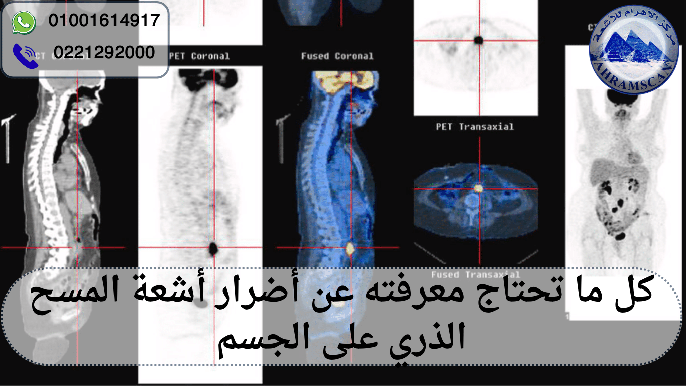أضرار أشعة المسح الذري على الجسم