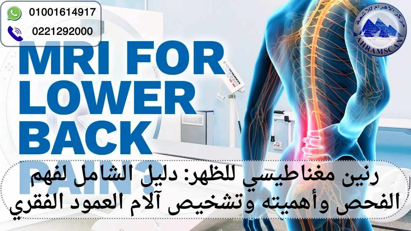 رنين مغناطيسي للظهر